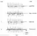 Fig. 02 - ARTICLES FOR TREATING CONCUSSION AND OTHER DISORDERS