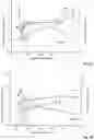 Fig. 03 - Pharmaceutical formulation for administering paracetamol by buccal/gingival route