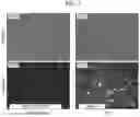 Fig. 08 - VIRAL METHODS OF T CELL THERAPY