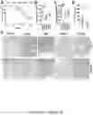 Fig. 02 - Compositions and methods of treating autoimmune disease by reducing enterococcus
