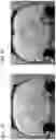 Fig. 02 - Functionalized magnetic nanoparticles and use in imaging amyloid deposits and neurofibrillary tangles