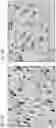 Fig. 07 - Functionalized magnetic nanoparticles and use in imaging amyloid deposits and neurofibrillary tangles