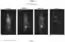 Fig. 08 - Labeled inhibitors of prostate specific membrane antigen (PSMA) as agents for the treatment of prostate cancer