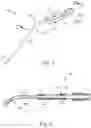 Fig. 02 - Suction instrument with varying inner diameter