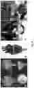 Fig. 04 - Synchronizing a pulsatile cardiac assist device with a pacemaker