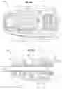 Fig. 12 - Systems and methods for sinus access