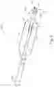 Fig. 07 - Dilation catheter with removable bulb tip