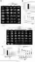 Fig. 03 - Butylphthalide-telmisartan hybrids, preparation method and application thereof