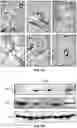 Fig. 13 - METHODS AND COMPOSITIONS FOR TREATING SOLID TUMORS AND ENHANCING TUMOR VACCINES