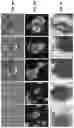 Fig. 09 - Microfluidic devices, systems, and methods for investigating three-dimensional cellular structures