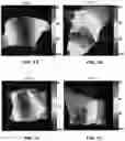 Fig. 02 - APPARATUS AND METHODS FOR IN VITRO PRECLINICAL HUMAN TRIALS