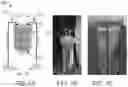 Fig. 02 - PERSONALIZED CELLULAR BIOMANUFACTURING WITH A CLOSED, MINIATURE CELL CULTURE SYSTEM