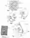 Fig. 03 - Scaffold and method for implanting cells