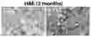 Fig. 01 - Stable three-dimensional blood vessels and methods for forming the same
