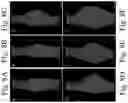 Fig. 10 - Collagen-binding agent compositions and methods of using the same