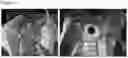Fig. 33 - Aluminium alloys for structural and non-structural near net casting, and methods for producing same
