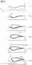 Fig. 04 - Method of manufacturing wind turbine rotor blades