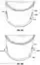Fig. 33 - Luminaire retention