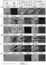 Fig. 04 - Method for cancer grading