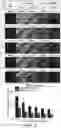 Fig. 05 - Method for cancer grading