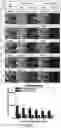 Fig. 06 - Method for cancer grading