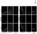 Fig. 06 - Methods and materials for identifying and treating autoimmune GFAP astrocytopathy