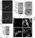 Fig. 07 - Methods and materials for identifying and treating autoimmune GFAP astrocytopathy
