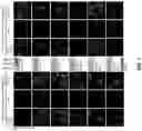 Fig. 08 - Methods and materials for identifying and treating autoimmune GFAP astrocytopathy