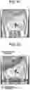 Fig. 07 - Magnetic resonance imaging apparatus and imaging processing method for determining a region to which processing is to be performed