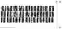 Fig. 01 - Method for processing an image of a papillary impression