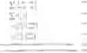 Fig. 08 - Object tracking in blind-spot