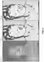 Fig. 07 - Zero order light removal in active sensing systems