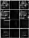 Fig. 01 - Computer vision systems and methods for real-time needle detection, enhancement and localization in ultrasound