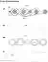 Fig. 06 - Wearable sensing device and sensor unit for acquiring one or more physiological signals of a subject