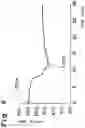 Fig. 07 - X-ray inspection device and method for determining degree of consumption of target of X-ray tube in X-ray inspection device