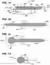 Fig. 02 - Methods and devices for repairing meniscal tissue