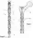 Fig. 02 - Intramedullary fixation device