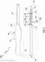 Fig. 04 - Valve prosthesis having a radially expandable sleeve integrated thereon for delivery and prevention of paravalvular leakage
