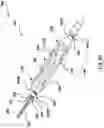 Fig. 15 - Valve prosthesis having a radially expandable sleeve integrated thereon for delivery and prevention of paravalvular leakage