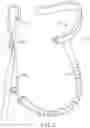Fig. 03 - ARM TENSIONING DEVICE TO PREVENT A SUPINE SLEEP POSITION