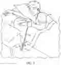 Fig. 04 - ARM TENSIONING DEVICE TO PREVENT A SUPINE SLEEP POSITION