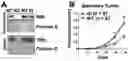 Fig. 01 - Methods of treating and preventing breast cancer with S-equol