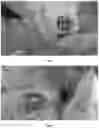 Fig. 02 - PHARMACEUTICAL COMPOSITION FOR TREATMENT OF INFLAMMATORY EAR DISEASES, METHOD FOR PRODUCING SAME AND METHOD FOR TREATMENT USING SAME COMPOSITION