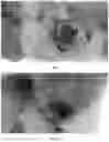 Fig. 06 - PHARMACEUTICAL COMPOSITION FOR TREATMENT OF INFLAMMATORY EAR DISEASES, METHOD FOR PRODUCING SAME AND METHOD FOR TREATMENT USING SAME COMPOSITION