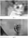 Fig. 07 - PHARMACEUTICAL COMPOSITION FOR TREATMENT OF INFLAMMATORY EAR DISEASES, METHOD FOR PRODUCING SAME AND METHOD FOR TREATMENT USING SAME COMPOSITION
