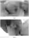 Fig. 08 - PHARMACEUTICAL COMPOSITION FOR TREATMENT OF INFLAMMATORY EAR DISEASES, METHOD FOR PRODUCING SAME AND METHOD FOR TREATMENT USING SAME COMPOSITION