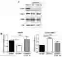 Fig. 01 - TRICYCLIC DIBENZOTHIAZEPINE TYPE COMPOUNDS FOR USE IN THE THERAPY OF CDKL5 DISORDER