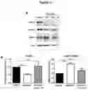 Fig. 02 - TRICYCLIC DIBENZOTHIAZEPINE TYPE COMPOUNDS FOR USE IN THE THERAPY OF CDKL5 DISORDER