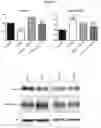 Fig. 04 - TRICYCLIC DIBENZOTHIAZEPINE TYPE COMPOUNDS FOR USE IN THE THERAPY OF CDKL5 DISORDER