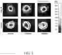 Fig. 04 - COMPOSITIONS AND METHODS FOR THE TREATMENT OF ORTHOPEDIC AILMENTS